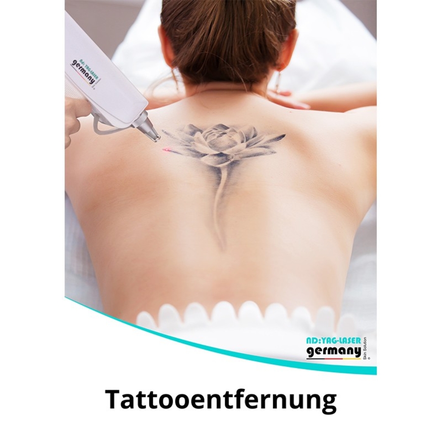 Tattooentfernung Poster Tattooentfernung Poster