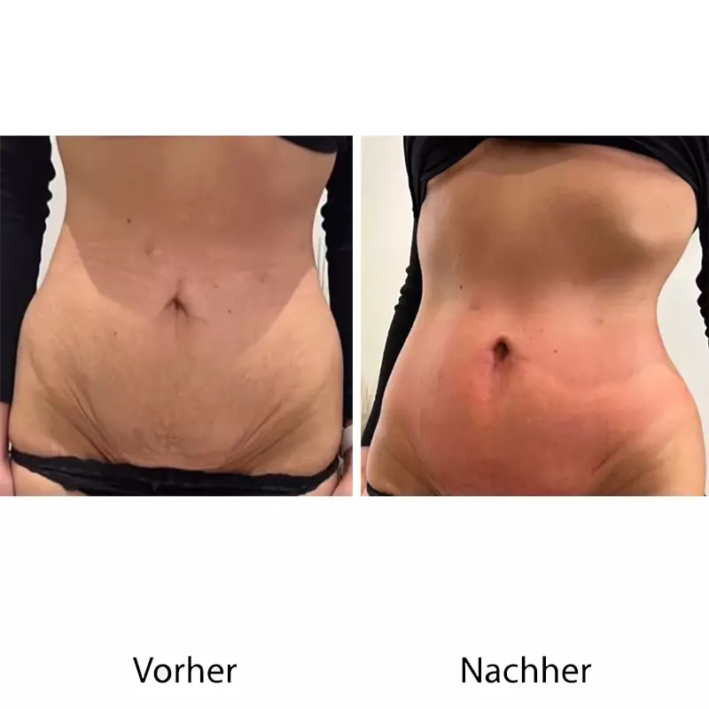 Vorher Nachher Bilder