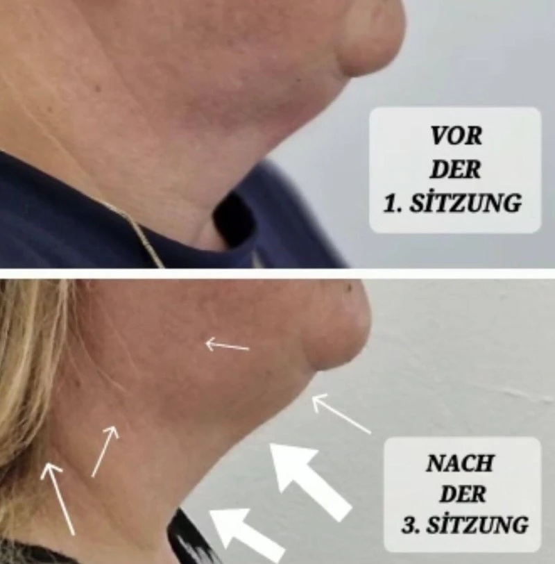 Vorher Nachher Bilder