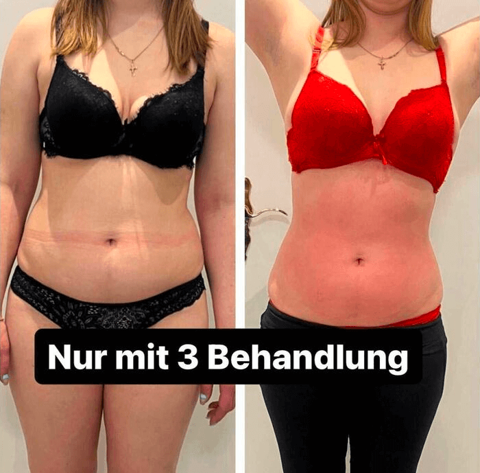 Vorher Nachher Bilder