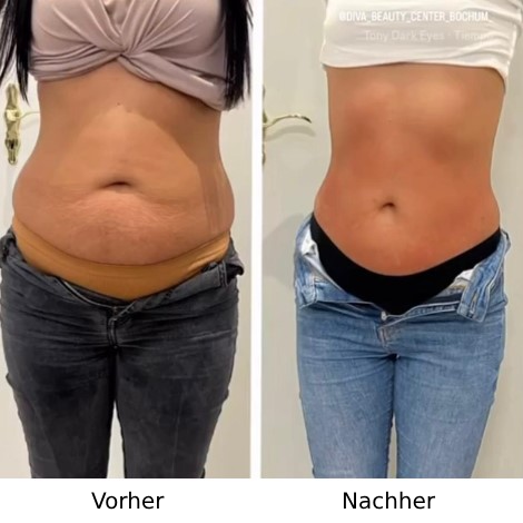 Vorher Nachher Bilder