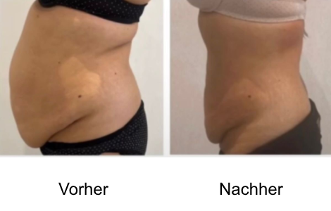 Vorher Nachher Bilder