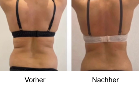 Vorher Nachher Bilder