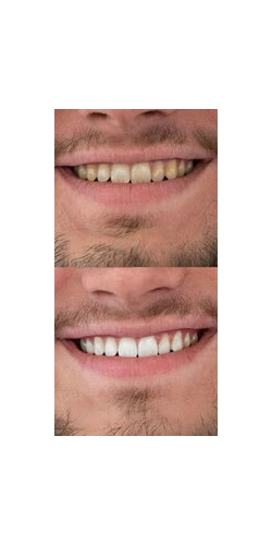 Behandlungsresultat vorher und nachher