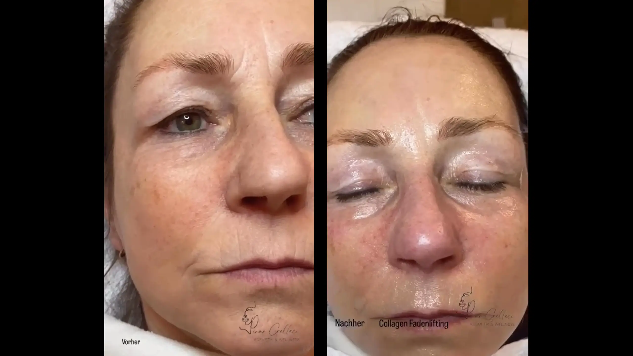 Vorschau-Bild fürs Video