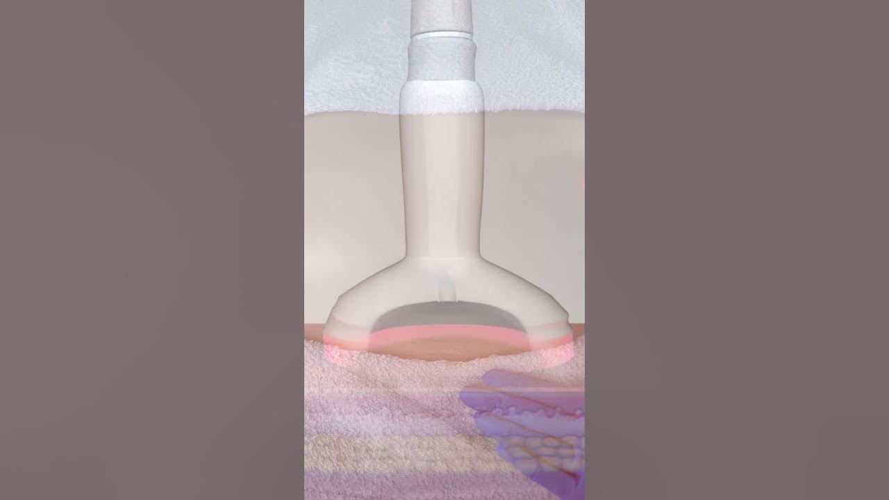 Vorschau-Bild fürs Video